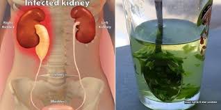 How to Get Rid of Kidney Infections Naturally